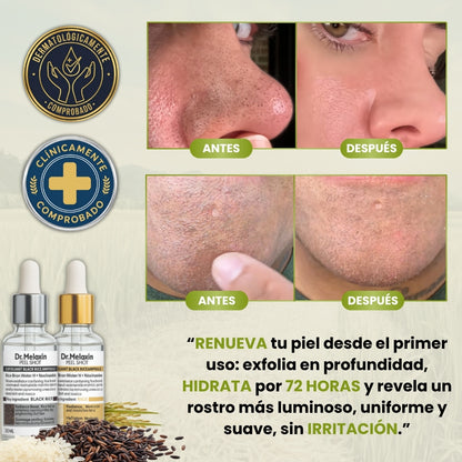 DrMelaxin™ | Sérum de Arroz Blanco & Arroz Negro 30ml